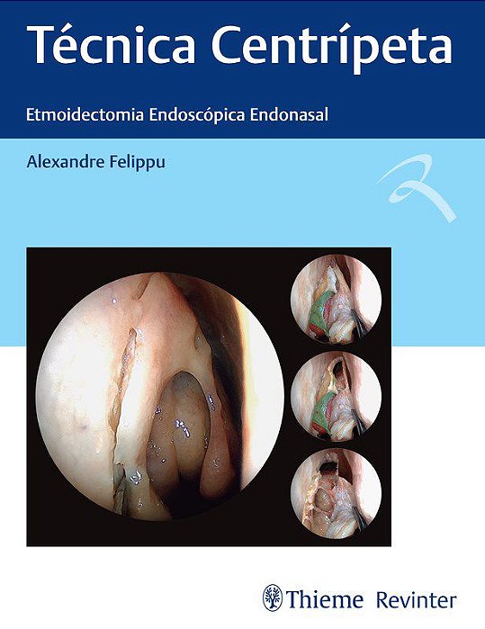 Livro Técnica Centripeta: Etmoidectomia Endoscópica Endonasal - Felippu - Revinter