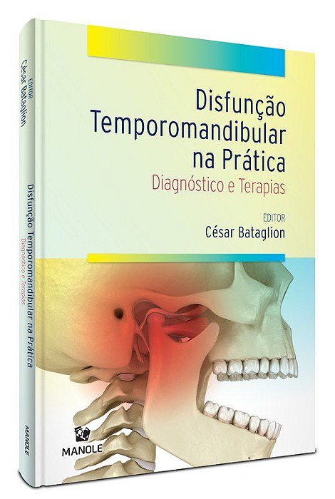 Livro Disfunção Temporomandibular na Prática: Diagnóstico e Terapias - Bataglion - Manole