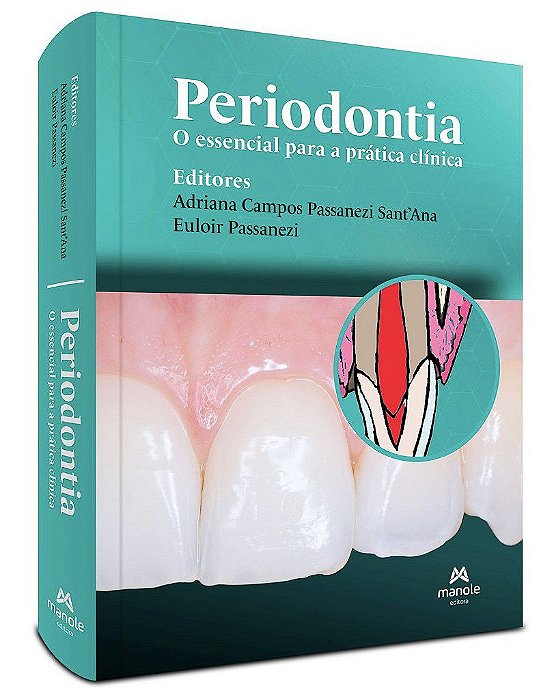 Livro Periodontia: o Essencial para a Prática Clínica - Santana - Manole