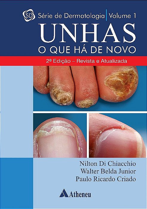 Livro Unhas: o Que Ha de Novo - Chiacchio/ Belda Jun