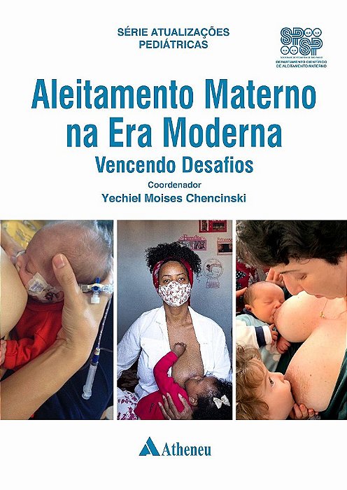 Livro Aleitamento Materno na Era Moderna: Chencinski: Atheneu