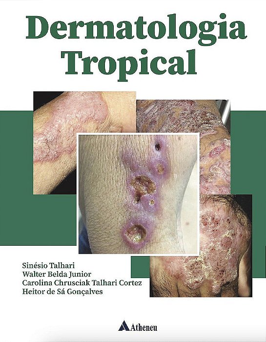 Livro Dermatologia Tropical - Talhari/belda Junior