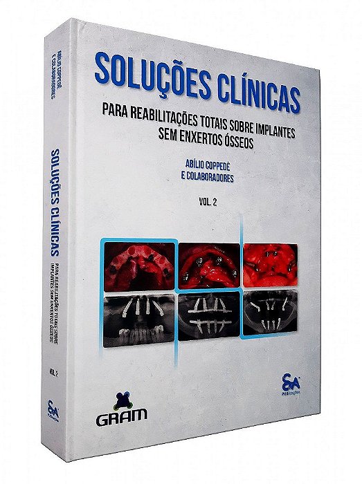 Livro Soluções Clínicas Para Reabilitações Totais Sobre Implantes sem Enxertos Ósseos