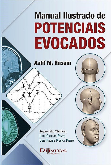Livro Manual Ilustrado de Potenciais Evocados  Husain