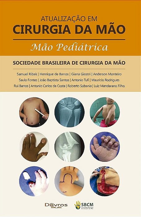Livro Atualização em Cirurgia da Mão - Mão Pediátrica - Ribak