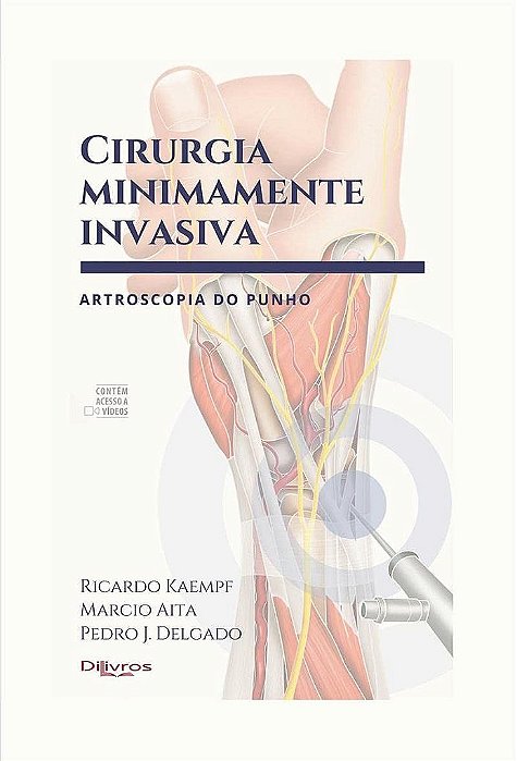 Livro Cirurgia Minimamente Invasiva Artroscopia do Punho