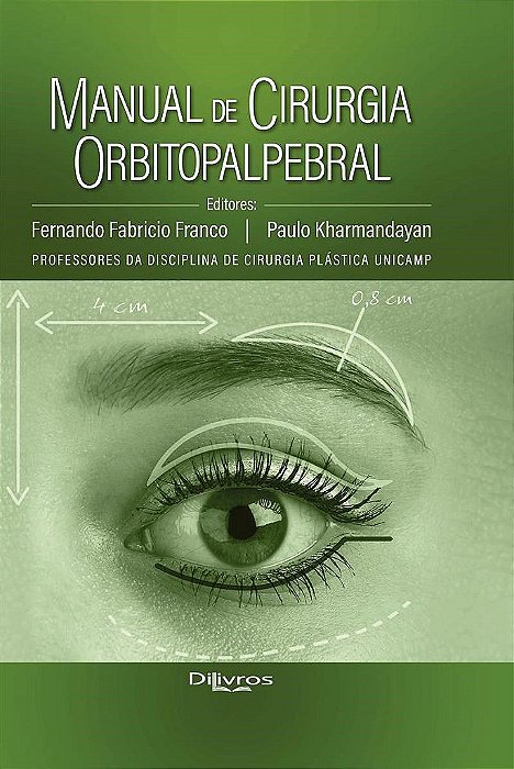 Livro Manual de Cirurgia Orbitopalpebral  Franco