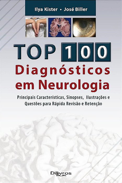 Livro Top 100 Diagnósticos em Neurologia