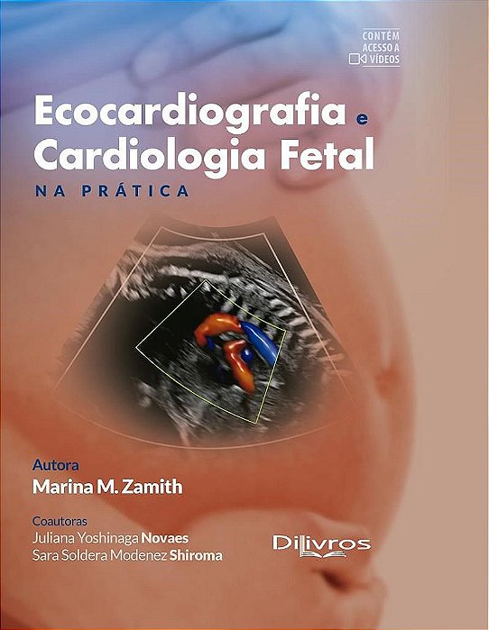 Livro Ecocardiografia e Cardiologia Fetal na Prática Zamith