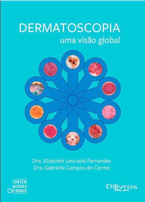 Livro Dermatoscopia Uma Visão Global