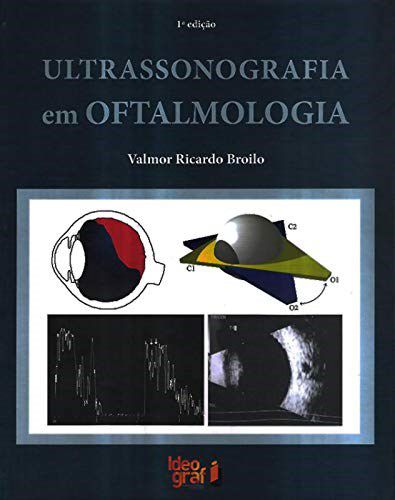 Livro Ultrassonografia em Oftalmologia