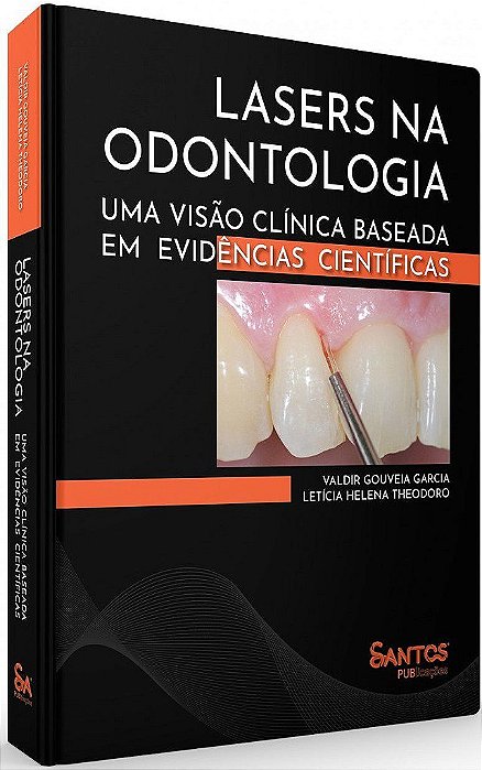 Livro Lasers Na Odontologia: Uma Visão Clínica Baseada em Evidências Cientiíicas