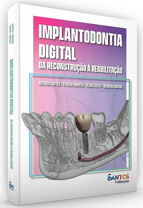 Livro Implantodontia Digital: da Reconstrução a Reabilitação