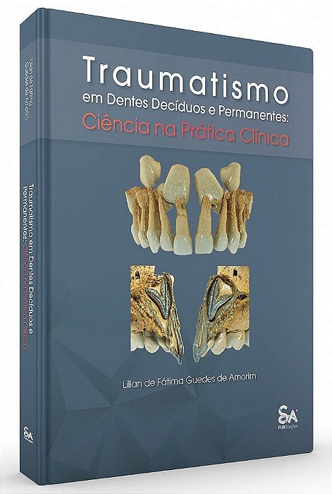 Livro Traumatismo em Dentes Decíduos e Permanentes - Amorim - Santos Pub