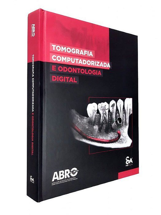 Livro Tomografia Computadorizada e Odontologia Digital - Abro - Santos Pub