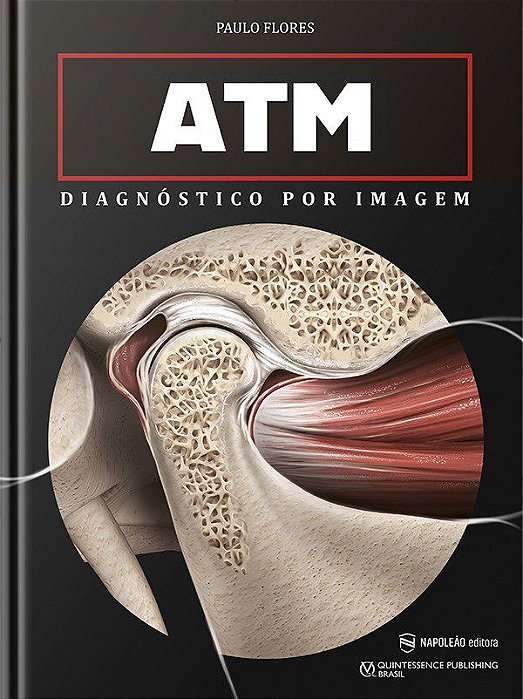 Livro ATM Diagnóstico por Imagem