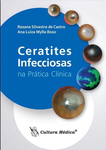 Livro Ceratites Infecciosas Na Prática Clínica
