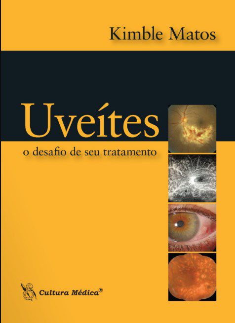 Livro Uveítes: O Desafio de seu Tratamento - Matos - Cultura Médica