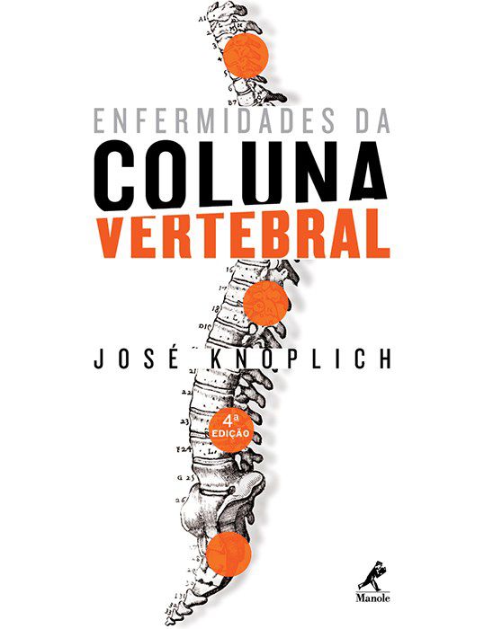 Livro Enfermidades da Coluna Vertebral *** - Knoplich - Manole