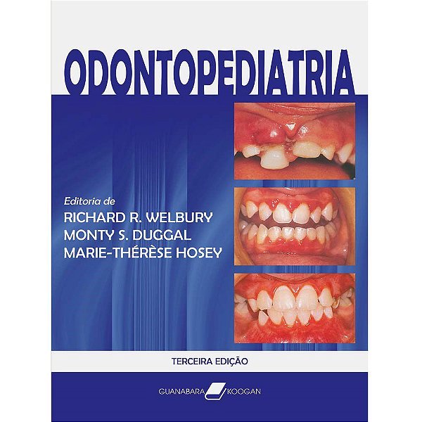 Livro Odontopediatria - Welbury/ Duggal