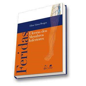 Livro Úlceras de Membros Inferiores: Borges