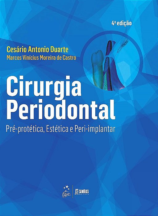 Livro Cirurgia Periodontal Pré-protética, Estética e Peri-implantar: Duarte/Santos