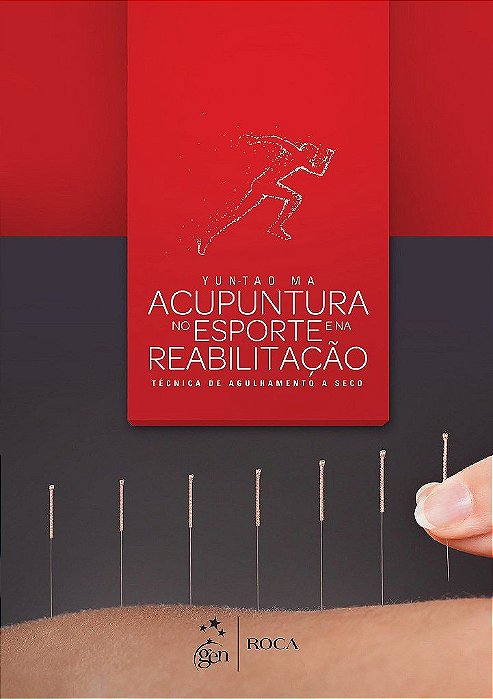 Livro Acupuntura no Esporte e na Reabilitação: Técnica de Agulhamento a Seco
