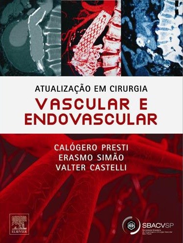 Livro Atualizacao em Cirurgia Vascular e Endovascular - Presti