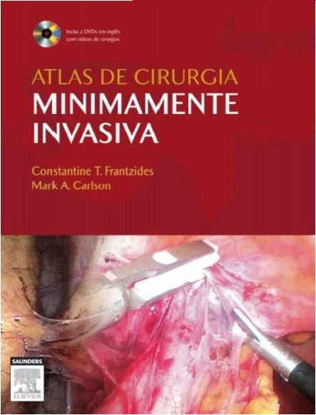 Livro Atlas de Cirurgia Minimamente Invasiva - Frantzides