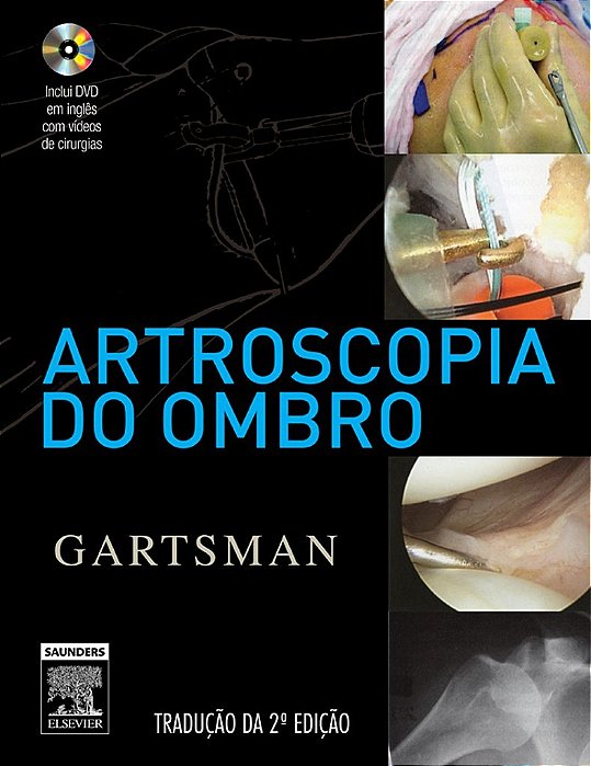 Livro Artroscopia do Ombro - Gartsman