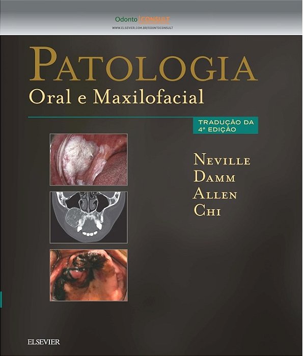 Livro Patologia Oral e Maxilofacial - Neville - Gen Guanabara