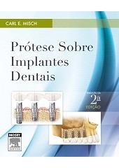 Livro Prótese sobre Implantes Dentais  Misch