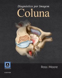 Livro Diagnostico Por Imagem: Coluna - Ross