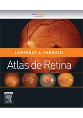 Livro Atlas de Retina Yannuzzi