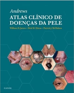 Livro Andrews Atlas Clínico de Doenças da Pele