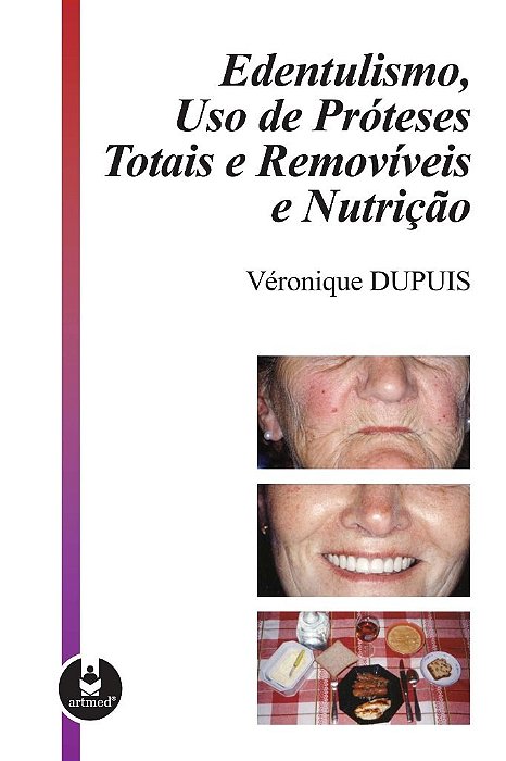 Livro Edentulismo, Uso de Proteses Totais e Removiveis e Nutricao - Dupuis