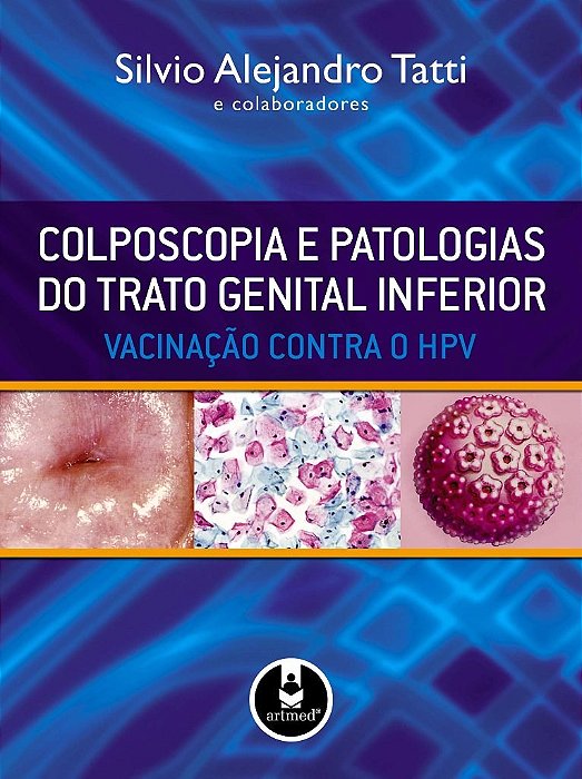 Livro Colposcopia e Patologias do Trato Genital Inferior