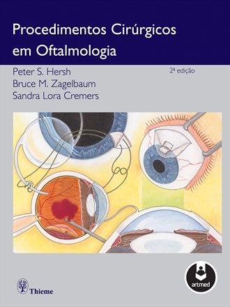 Livro Procedimentos Cirurgicos em Oftalmologia - Hersh/zagelbaum/crem