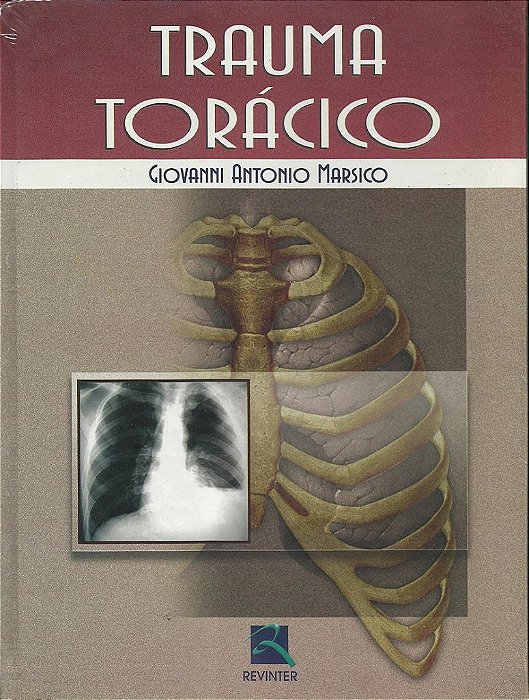 Livro Trauma Toracico - Marsico