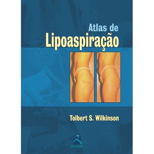 Livro Atlas de Lipoaspiração - Wilkinson