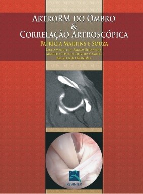 Livro ARTRORM do Ombro & Correlação Artroscópica - Souza