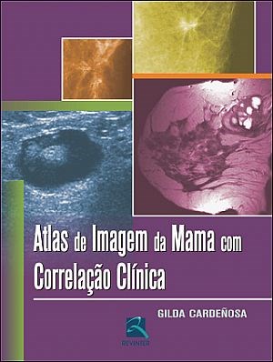 Livro Atlas de Imagem da Mama com Correlação Clínica - Cardenosa