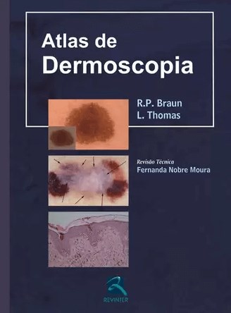 Livro Atlas de Dermoscopia