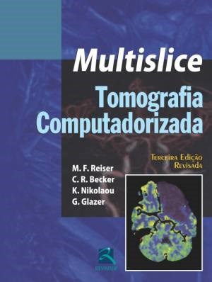 Livro Tomografia Computadorizada Multislice