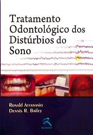 Livro Tratamento Odontologico dos Disturbios do Sono - Attanasio