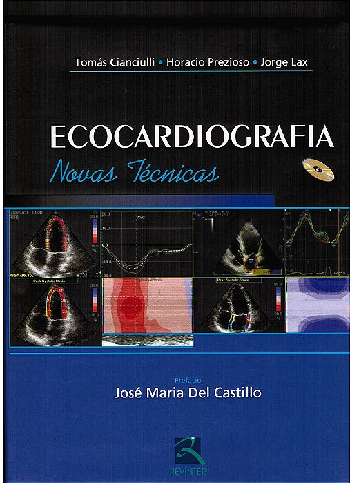 Livro Ecocardiografia: Novas Tecnicas - Cianciulli/prezioso