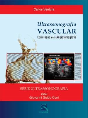 Livro Ultrassonografia Vascular - Ventura/cerri