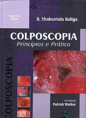 Livro Colposcopia Princípios e Prática