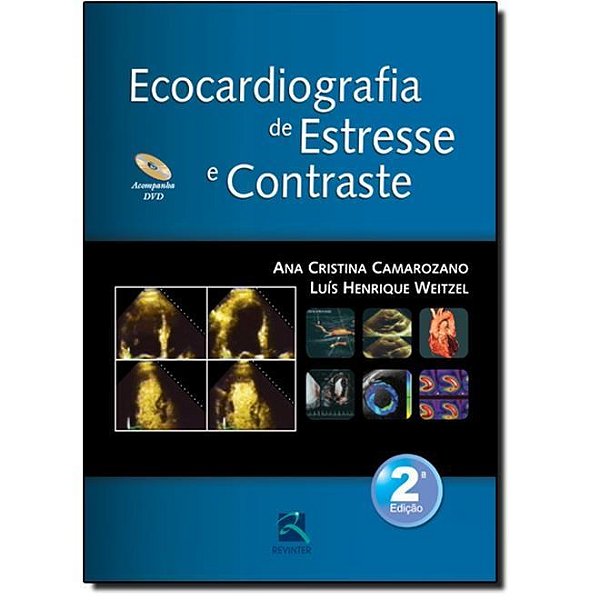 Livro Ecocardiografia de Estresse e Contraste - Camarozano/weitzel