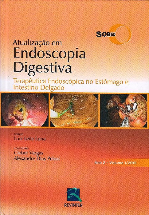Livro Terapêutica Endoscópica Estômago e Intestino Delgado SOBED